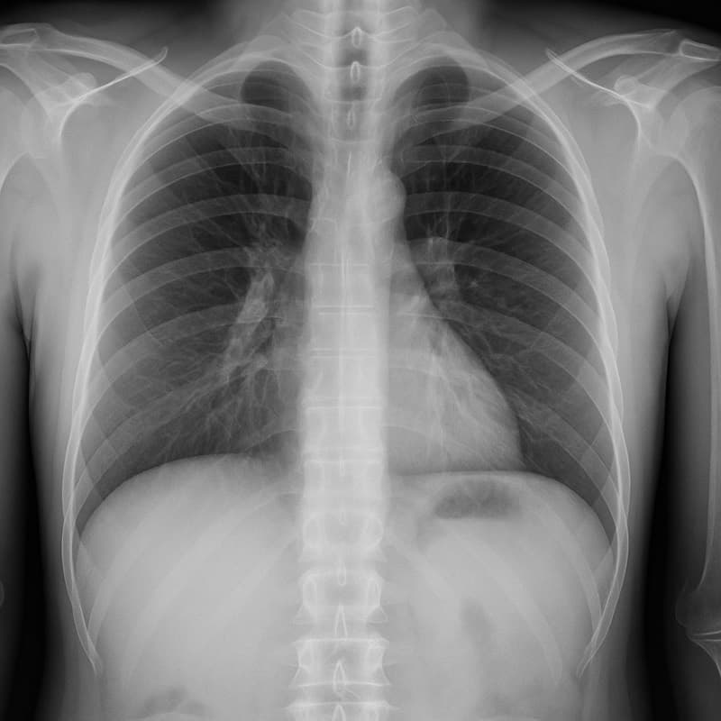 Case image from the RADIX Viva bank