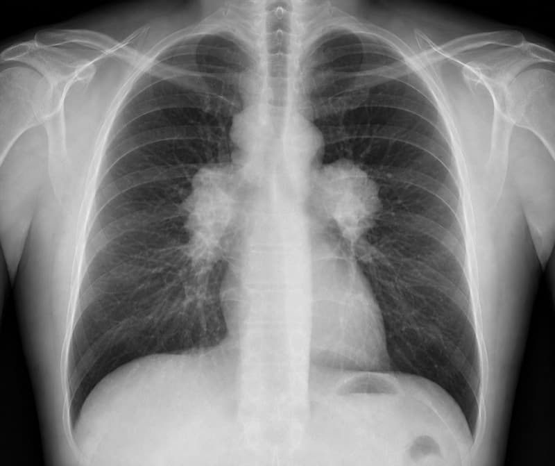 Chest radiograph from the RADIX Viva case bank